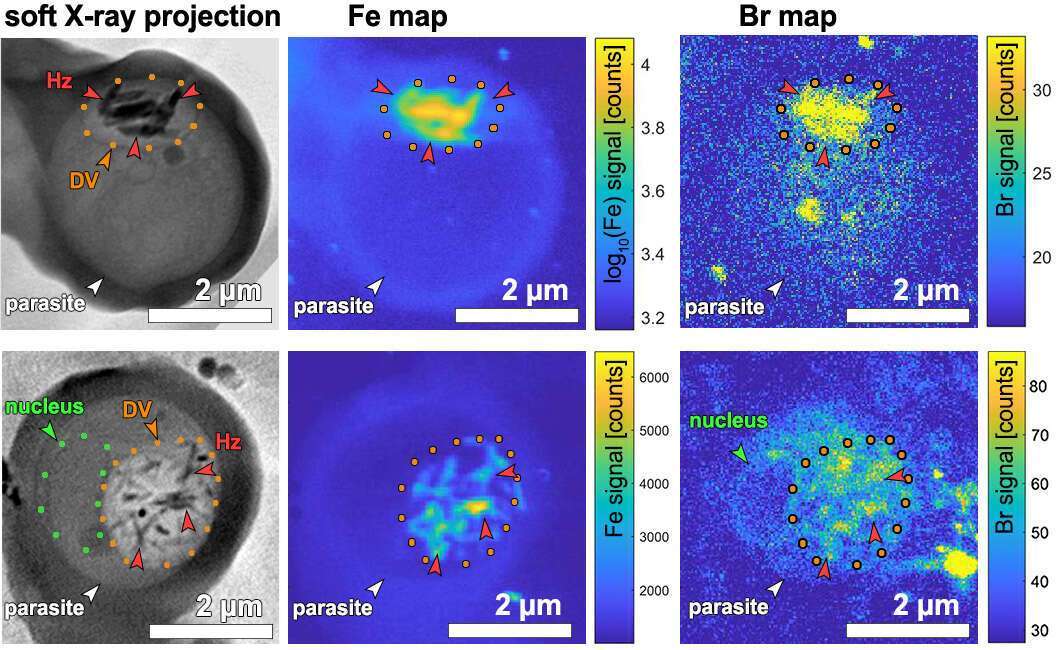 Figure 1. Soft X-ray cryo-tomography (SXT) re-projection images and X-ray fluorescence maps of two malaria parasite-infected red blood cells. Left: SXT maps. Center: iron (Fe) maps. Right: bromine (Br) maps. DV – digestive vacuole delineated with orange dots containing iron-dense hemozoin (Hz) crystals.